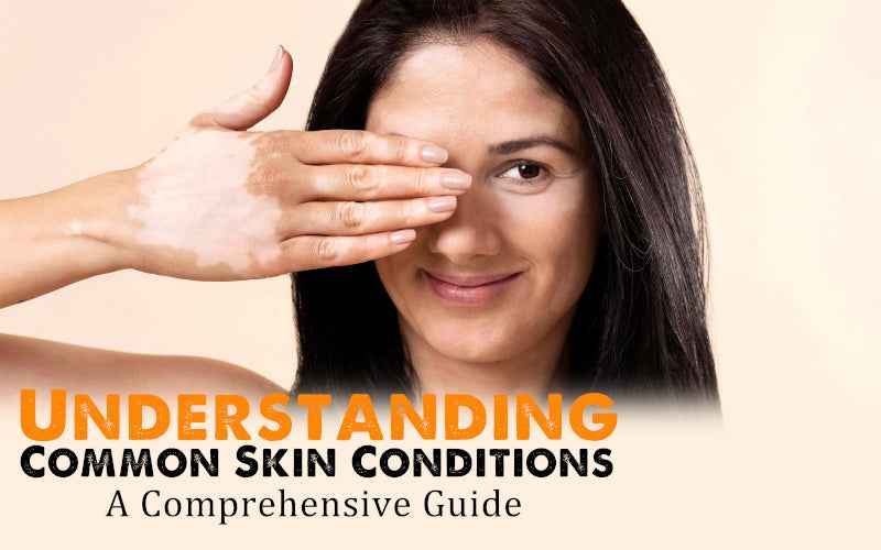 Understanding Common Skin Conditions: A Comprehensive Guide - Healing Pharma
