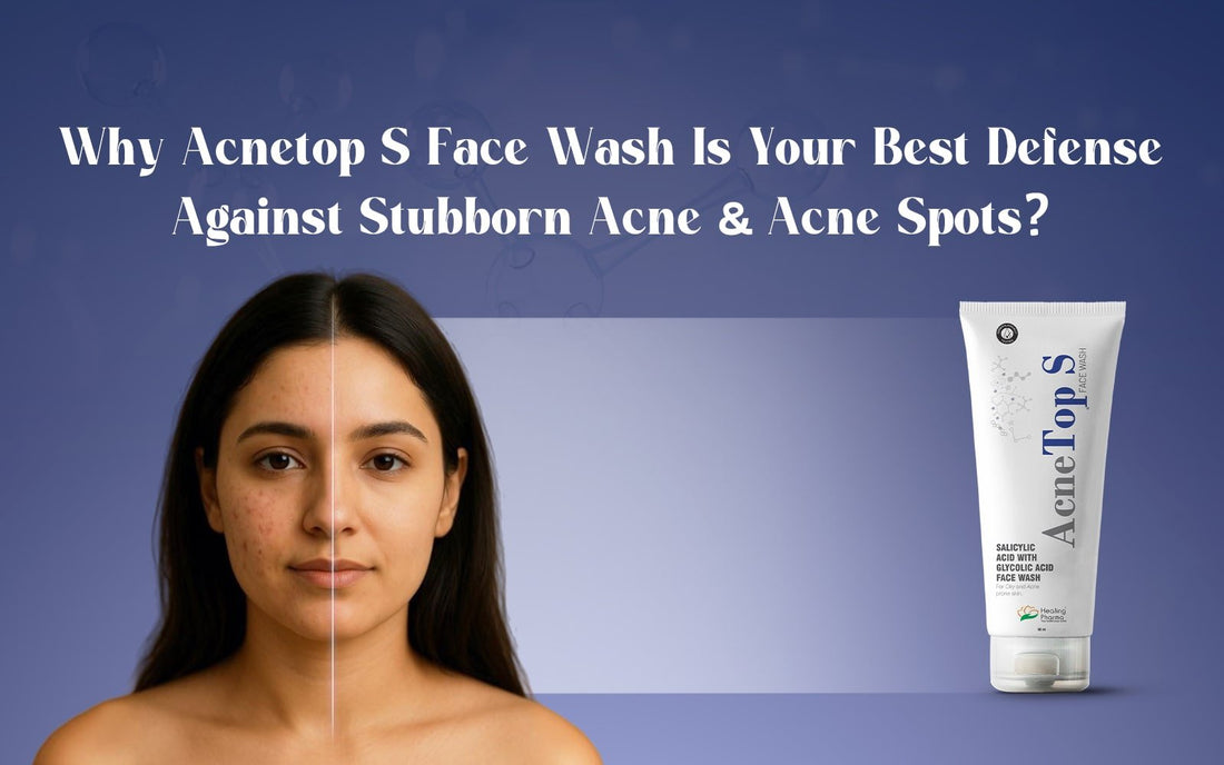 Why Acnetop S Face Wash Is Your Best Defence Against Stubborn Acne & Acne Spots? - Healing Pharma