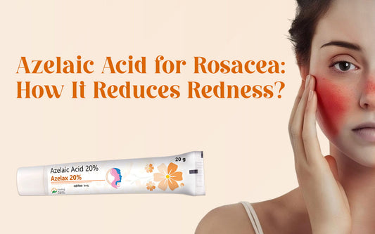 Azelaic Acid for Rosacea