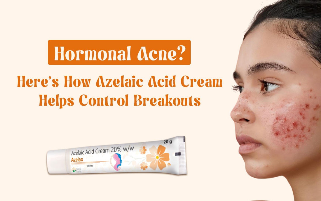 Hormonal Acne? Here’s How Azelaic Acid Cream Helps Control Breakouts! - Healing Pharma