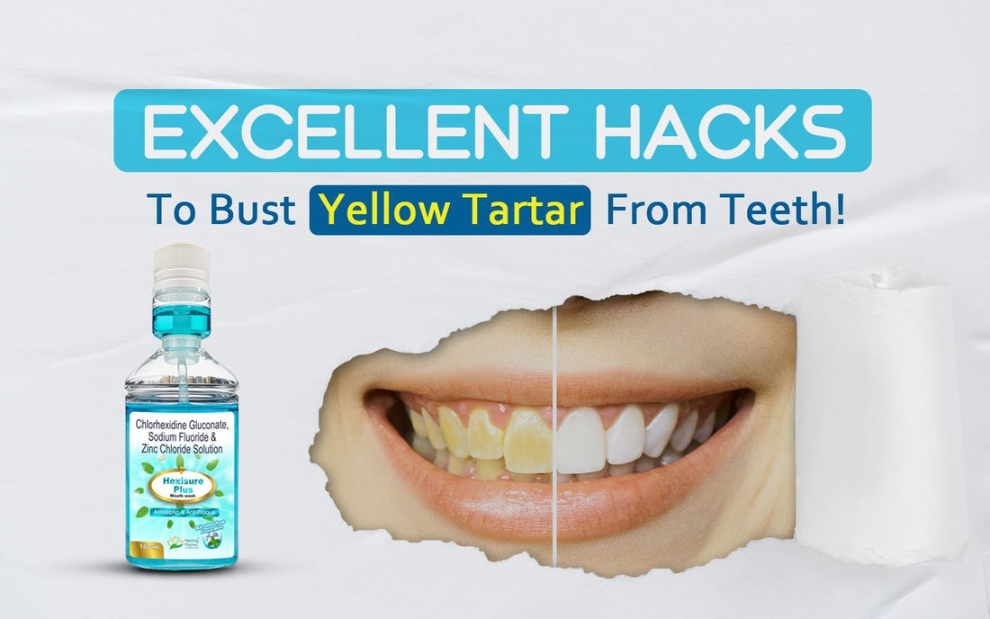 Excellent Hacks to Bust Yellow Tartar from Teeth! - Healing Pharma
