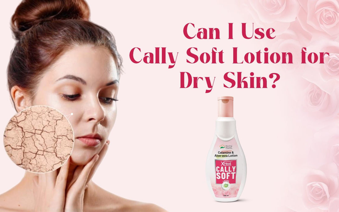 Can I Use Cally Soft Lotion for Dry Skin? - Healing Pharma