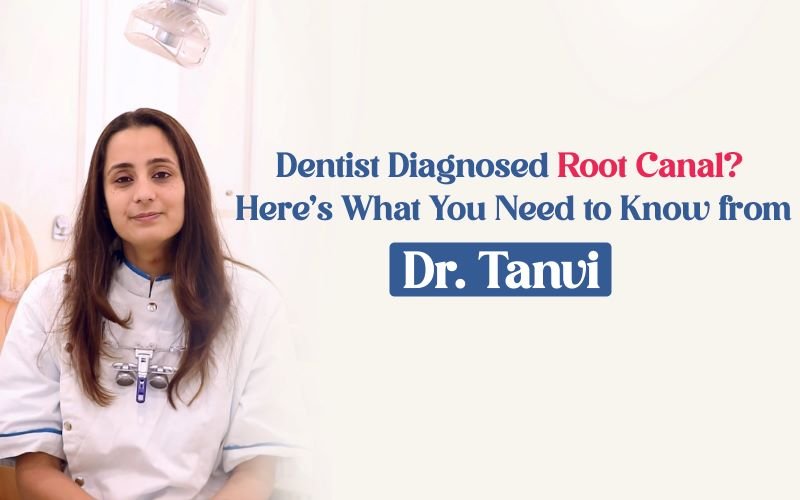 Dentist Diagnosed A Root Canal? Here’s What You Need to Know from Dr. Tanvi Thaper - Healing Pharma