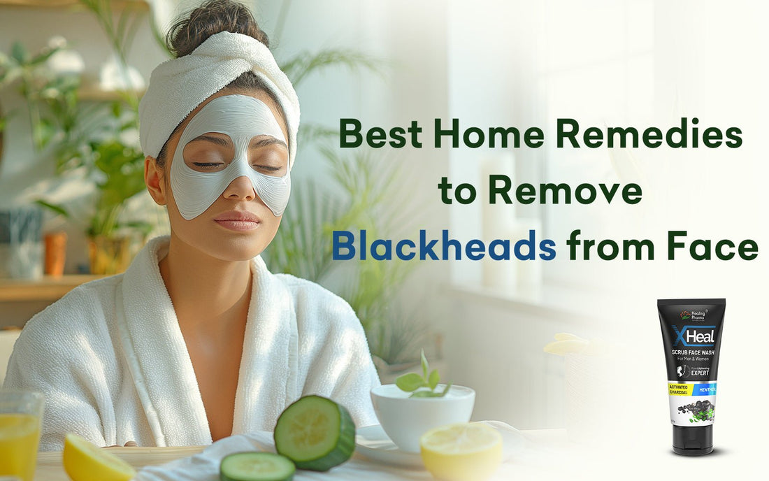 Best Home Remedies to Remove Blackheads from Face - Healing Pharma