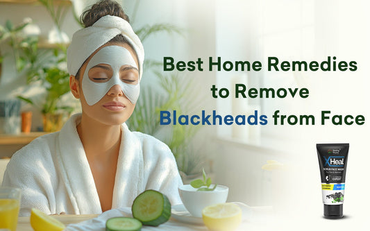 Best Home Remedies to Remove Blackheads from Face - Healing Pharma