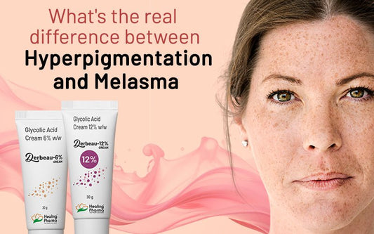 What's The Real Difference Between Hyperpigmentation & Melasma - Healing Pharma