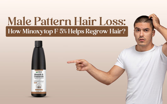 Male pattern hair loss treatment