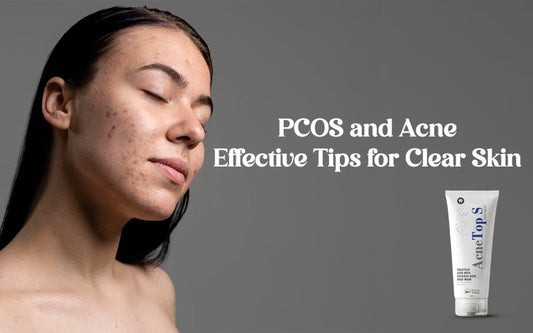 PCOS and Acne: Effective Tips for Clear Skin - Healing Pharma