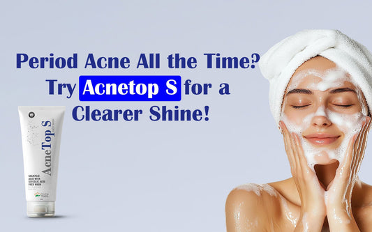 Period Acne All the Time? Try Acnetop S for a Clearer Shine! - Healing Pharma