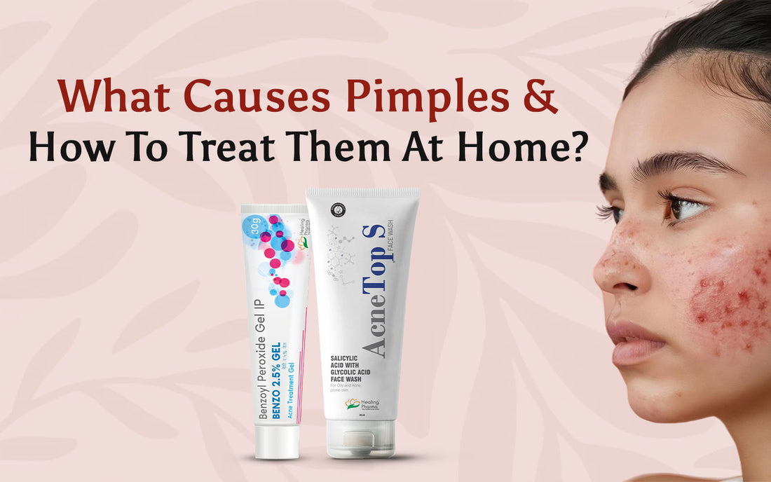 Pimples Digusting What Causes Pimples & Home Treatment Guide – Healing Pharma