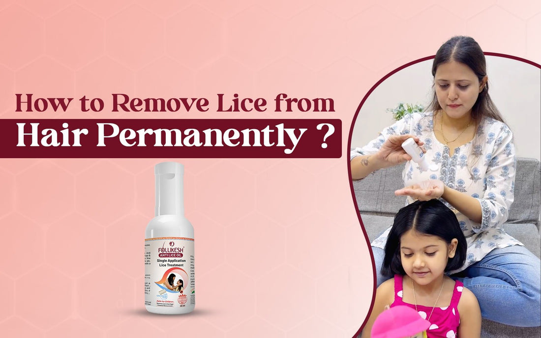 How to Remove Lice from Hair Permanently? - Healing Pharma
