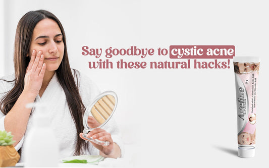 Say Goodbye to Cystic Acne with These Natural Hacks! - Healing Pharma
