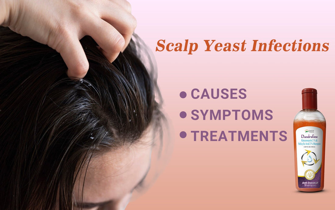 Scalp Yeast Infections: Causes, Symptoms, and Treatments - Healing Pharma