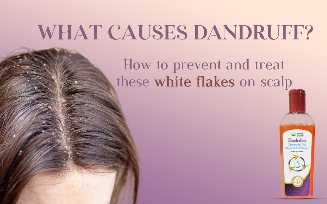 What Causes Dandruff? How To Prevent and Treat These White Flakes on Scalp - Healing Pharma