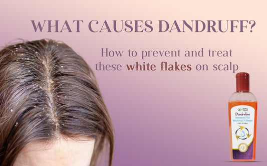 What Causes Dandruff? How To Prevent and Treat These White Flakes on Scalp - Healing Pharma