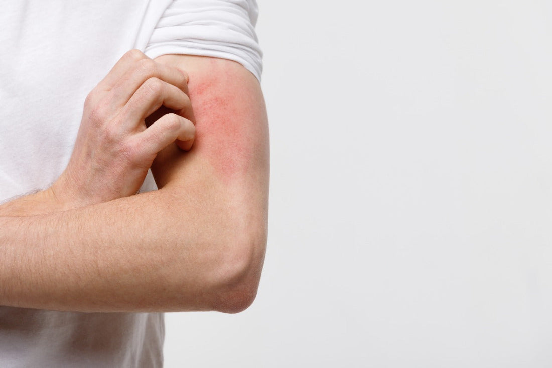 World Psoriasis Day: Know 6 Myths and Facts About This Condition - Healing Pharma