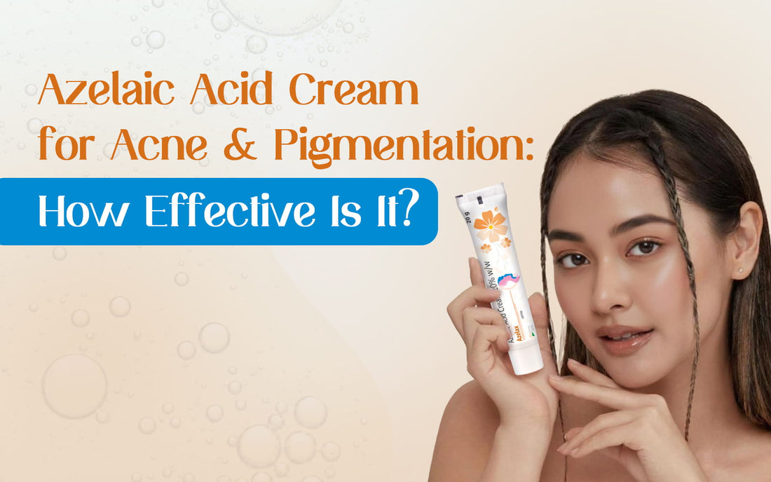 azelaic acid cream for acne