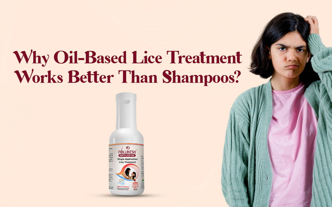 best Anti Lice Hair Oil in india