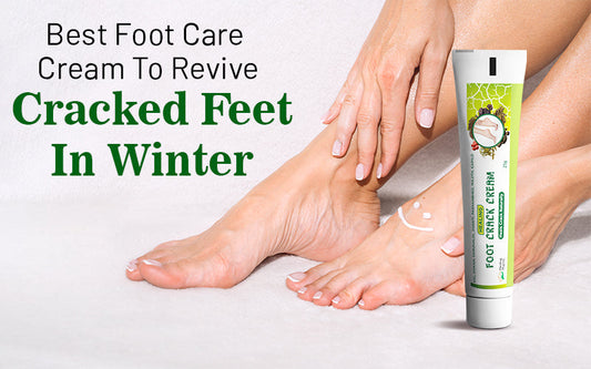 Best Foot Care Cream to Revive Cracked Feet in Winter - Healing Pharma