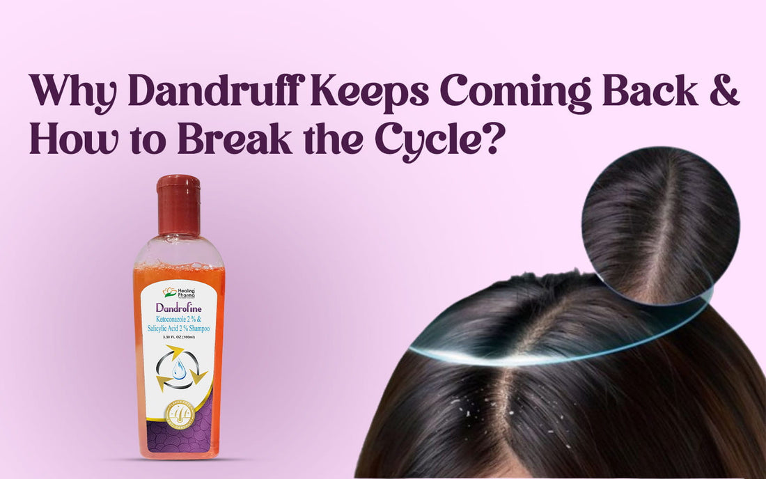 dandruff keeps coming back