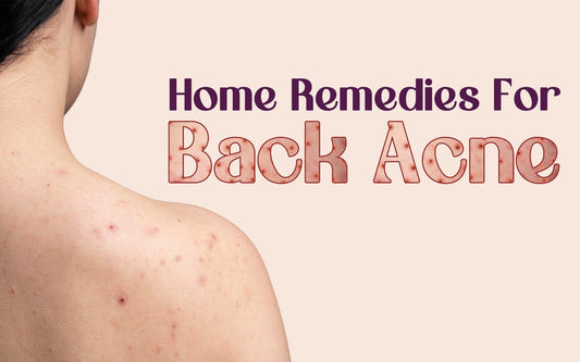 Home Remedies For Back Acne - Healing Pharma