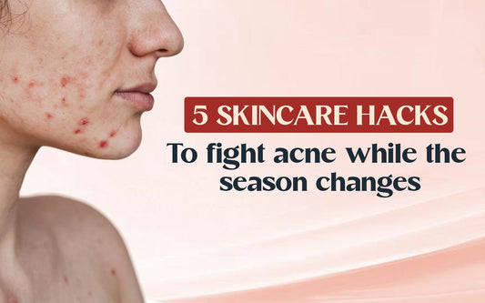 5 Skincare Hacks To Fight Acne While The Season Changes - Healing Pharma