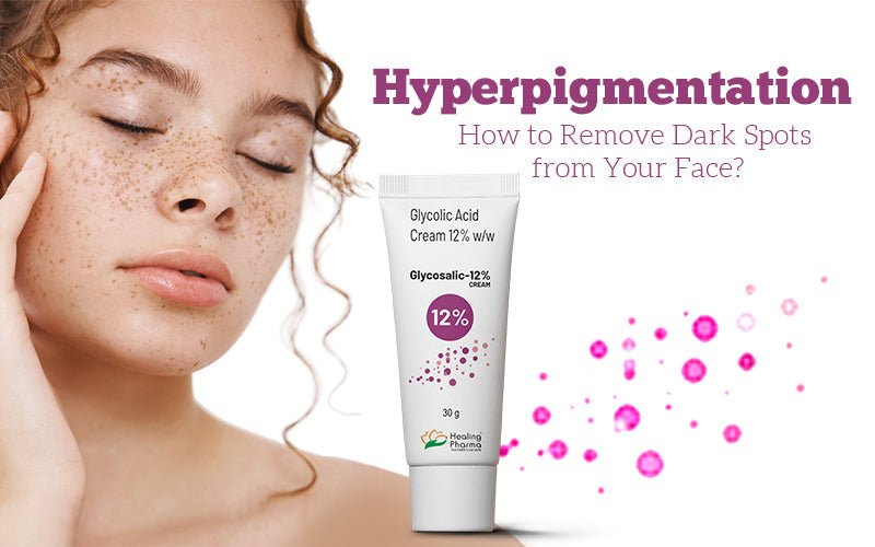 Hyperpigmentation: How to Remove Dark Spots from Your Face - Healing Pharma