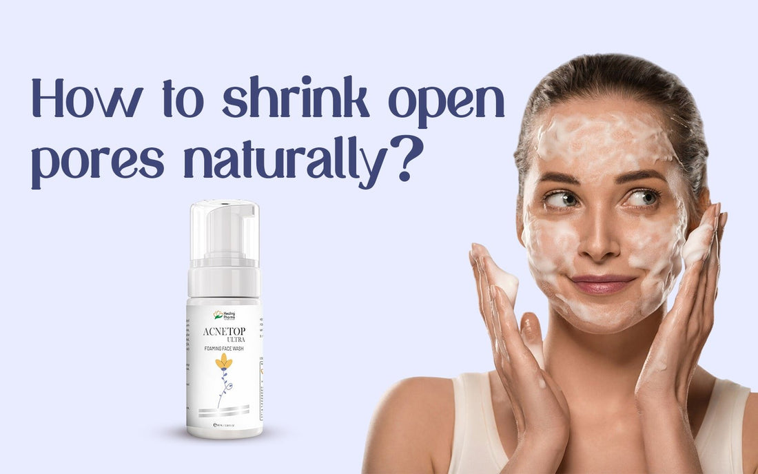 How to shrink open pores naturally? - Healing Pharma