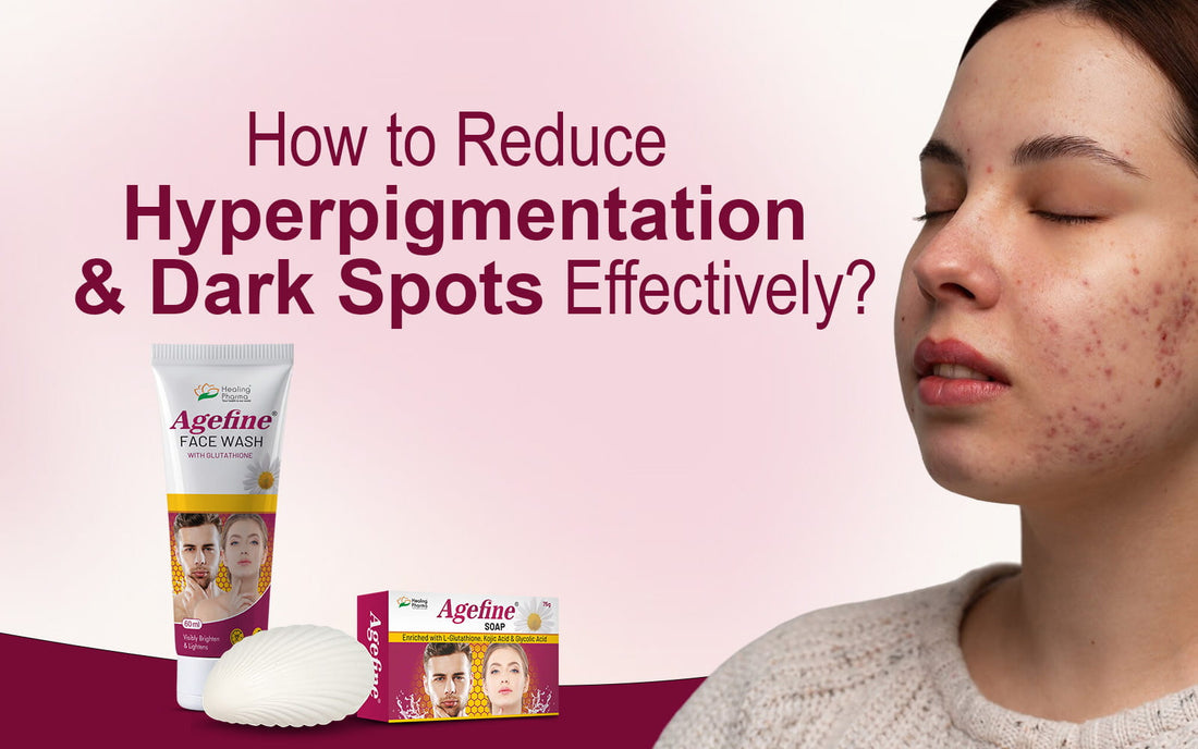 what causes hyperpigmentation