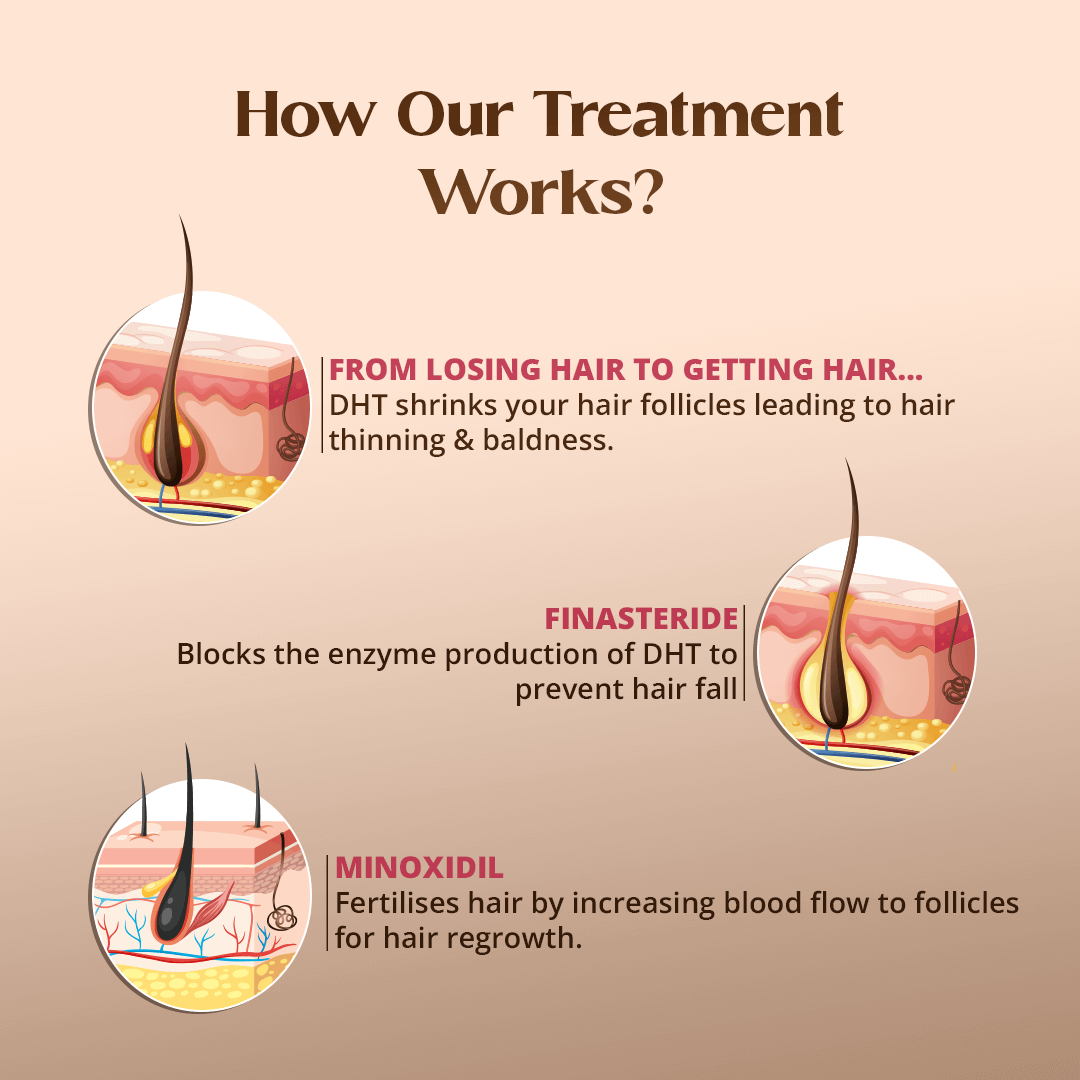 Minoxytop F 5% - Minoxidil Finasteride Hair Regrowth Solution