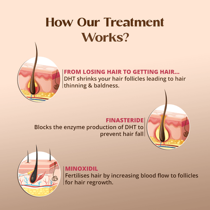 Minoxytop F 5% - Minoxidil Finasteride Hair Regrowth Solution