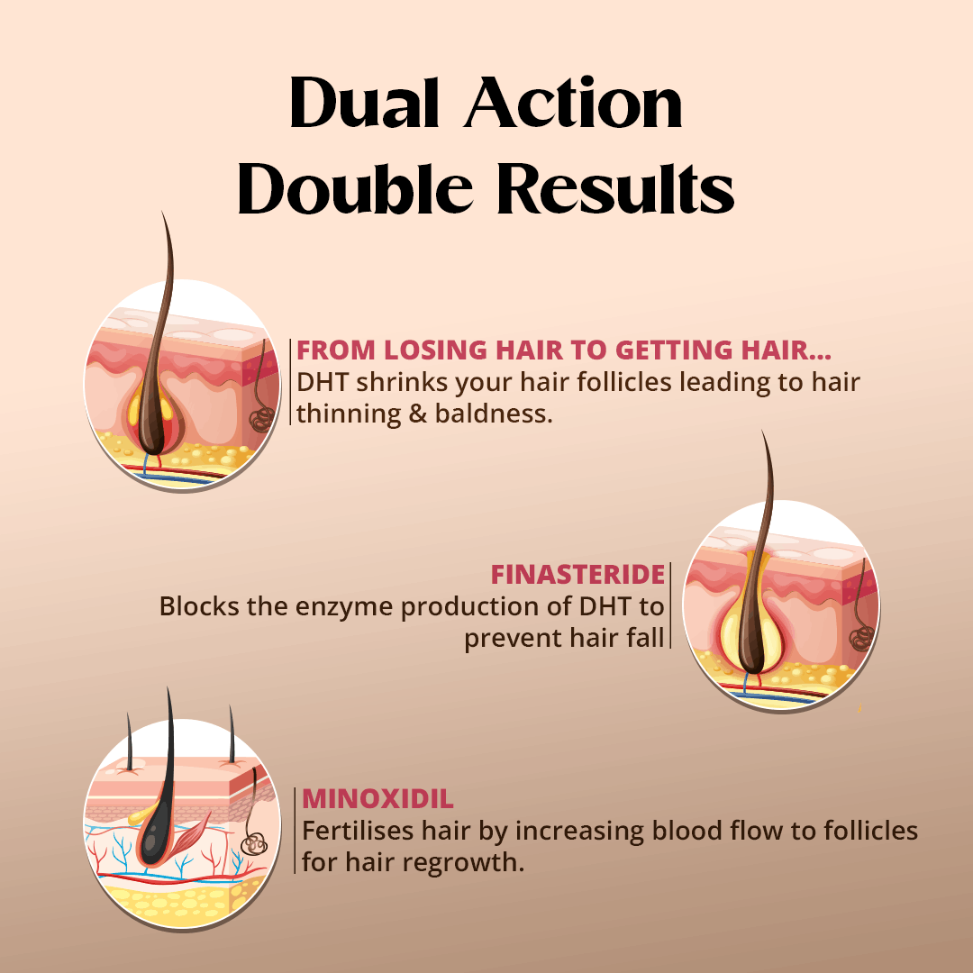 Best Hair growth solution online