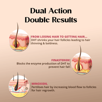 Best Hair growth solution online