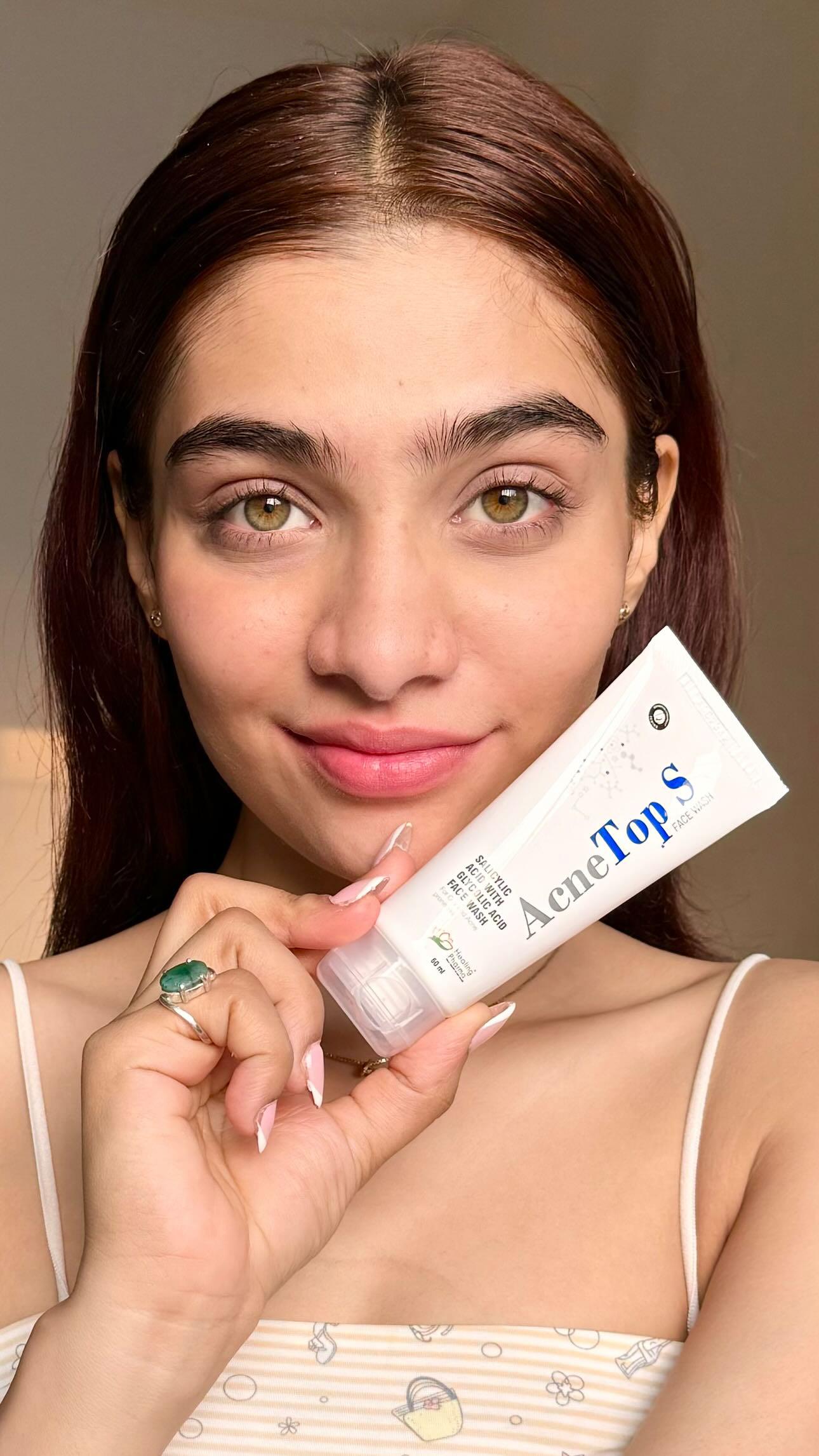 acnetop s facewash