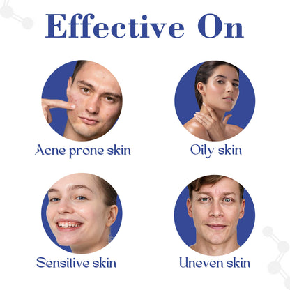 Healing Pharma AcneTop S Facewash with Salicylic Acid & Glycolic Acid